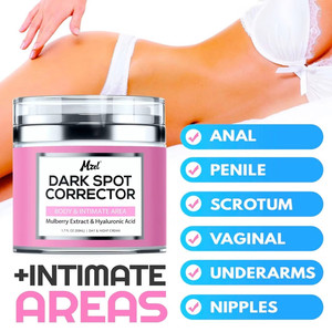 Crème anti-taches <span class=keywords><strong>pour</strong></span> le corps, le <span class=keywords><strong>visage</strong></span>, le bikini et les zones sensibles, crème correctrice des taches <span class=keywords><strong>pour</strong></span> les zones intimes - Product Image 3