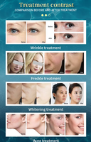 Appareil de soin du visage hydro-jet à 6 canaux, jet d'oxygène, rajeunissement de la peau, élimination de l'acné, nettoyage en profondeur des pores, équipement esthétique