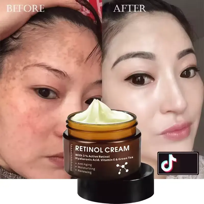 Oem chống lão hóa làm trắng đốm đen mạnh mẽ tẩy trắng loại bỏ nếp nhăn Collagen Retinol Vitamin C tàn nhang Kem