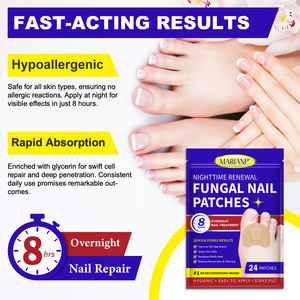 24 patchs de nuit pour ongles pour réparer et soigner les ongles et les <span class=keywords><strong>pieds</strong></span> abîmés, restaurer la décoloration et l'épaisseur MARIANP - Product Image 6