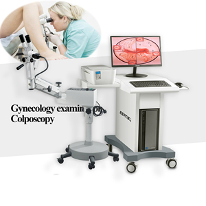 KN-2200BI inti Video AI HD Colposcope Video rumah sakit Colposcope dengan troli untuk ginekologi optical colposcope - Product Image 2