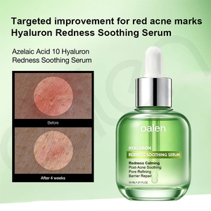 Sérum facial à l'acide azélaïque Oalen Private Label, hydratant, soin des imperfections, réduit les rougeurs de la <span class=keywords><strong>peau</strong></span>, adapté aux peaux sensibles et grasses - Product Image 2