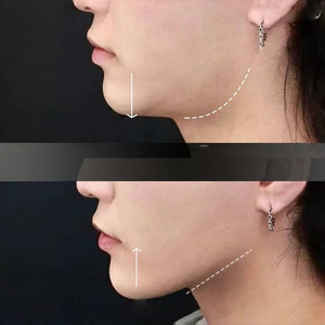 Nhà máy OEM sản phẩm làm săn chắc da mặt, loại bỏ mỡ thừa vùng cằm, giảm bọng mắt, nâng mặt tức thì, làm săn chắc da mặt, tạo đường nét chữ V. - Product Image 4