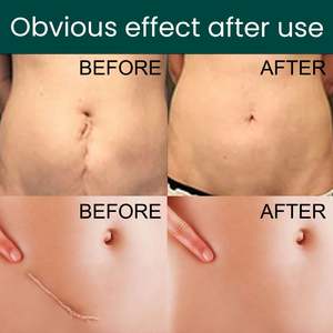 แผ่นซิ<span class=keywords><strong>ล</strong></span>ิโคนดูแลผิว แผ่นซิ<span class=keywords><strong>ล</strong></span>ิโคน<span class=keywords><strong>ล</strong></span>ดรอยแผ<span class=keywords><strong>ล</strong></span>เป็น แผ่นซิ<span class=keywords><strong>ล</strong></span>ิโคนใส แผ่นแปะลดรอยแผ<span class=keywords><strong>ล</strong></span>เป็น เจ<span class=keywords><strong>ล</strong></span>ซ่อมแซมแผลไฟไหม้ แผ่นซิ<span class=keywords><strong>ล</strong></span>ิโคนนุ่มสำหรับศั<span class=keywords><strong>ล</strong></span>ยกรรม แผ่นแปะติดเอง - Product Image 4