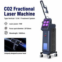 Perfectlaser 3 en 1, machine à laser fractionné au CO2 à tube RF 70W pour le resserrement vaginal, l'élimination des cicatrices d'acné, laser fractionné au CO2