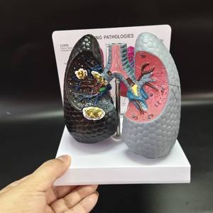 عرض مقارن لموديلات أمراض الجهاز التنفسي البشري بين الرئة المدخنة والرئة الصحية - Product Image 2