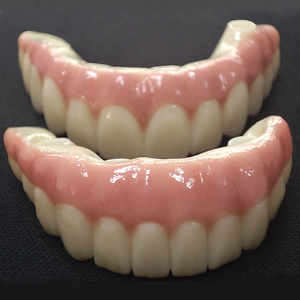 Prothèse dentaire implantable hybride avec fournitures en porcelaine pour les gencives, abutments personnalisés en zircone et titane pour les implants, tout sur 4 - Product Image 3