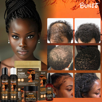 Kit personnalisé de traitement de la repousse des cheveux huile de fenugrec Karkar Chebe bio shampooing à la biotine ensemble de sérum après-shampoing pour la pousse des cheveux