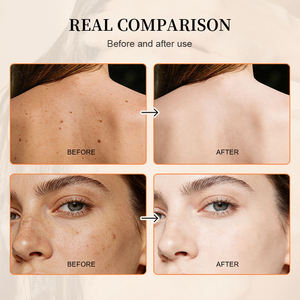 Jabón de Ácido Kójico y Cúrcuma, Muestra Gratis, Blanqueador, Aclarante, Tratamiento para el Acné, Jabón Facial en Barra, Hecho a Mano - Product Image 4