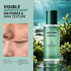 Suero Reductor de Poros con Algas Marinas, Hidratante y Antiarrugas, Control de Grasa, Reduce Marcas de Acné, Fabricación de Marca Privada OEM - Product Image 3