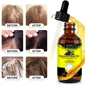 USA <strong>UK</strong> InStock Natural Organic Hair Regrowth <strong>Oil</strong> Moisturizing Hairloss Treatment Essential <strong>Oil</strong> Hair Growth Serum <strong>Black</strong> <strong>Seed</strong> <strong>Oil</strong> - Product Image 3
