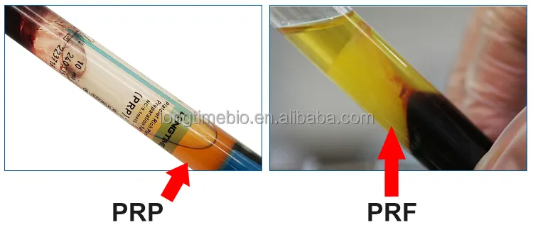 Médico 10ml 15ml laboratorio de vidrio I PRF tubo rico en plaquetas para el rejuvenecimiento de la piel