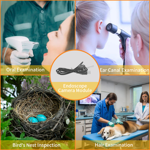 Módulo de Cámara Endoscópica USB2.0 de 0.3MP con Sensor CMOS BF20A6 de 5mm para Examen Oral. - Product Image 2