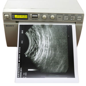 Pemindaian medis lebar A6 UPP-110S UPP-110HG Video hitam dan putih kertas Film Ultrasound termal Media kertas kasir - Product Image 6