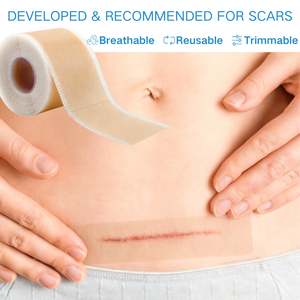 Fita de Silicone Médica Profissional para Cicatrizes, Estrias e Remoção de Protuberâncias, Atacado a Granel - Product Image 6