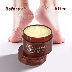 CINDYNAL Wholesale Moisturizing anti dry foot crack repair urea Horse Oil Hands Feet foot care cream for cracked heels