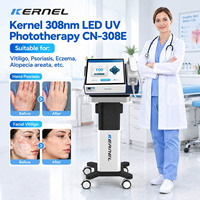 Traitement médical du psoriasis, du vitiligo et de l'eczéma par laser excimer 308 nm, photothérapie UVB, appareil laser excimer 308 nm