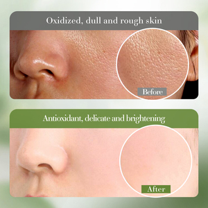 SADOER OEM – Sérum Visage Anti-Âge et Hydratant à l'Extrait Naturel, Essence Éclaircissante pour le Visage, Marque Privée, Vente en Gros - Product Image 6