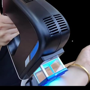Sistema Excimer de 308nm sin Consumibles de Repuesto, Bajo Costo de Mantenimiento, para Vitiligo y Eccema - Product Image 3