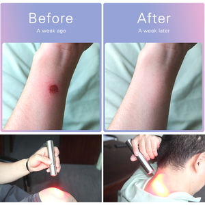 Ideatherapy handy TL09-A 630:660:850nm充電式赤色光療法ワンド赤色光療法トーチペットと人間の痛みの緩和 - Product Image 3