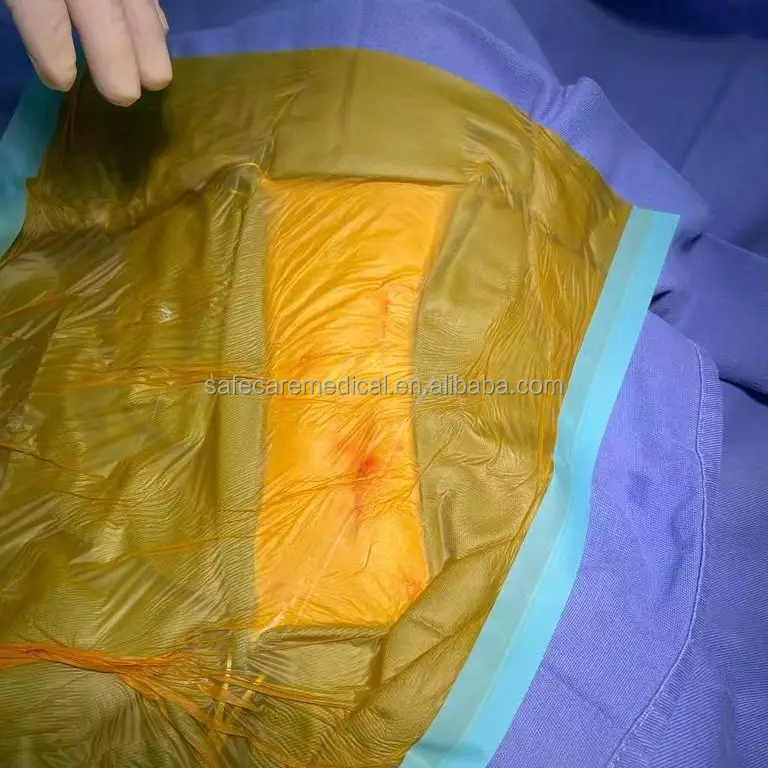 Su geçirmez steril yapıştırıcı cerrahi Film PU cerrahi kesi filmi iyot 45CMX65CM