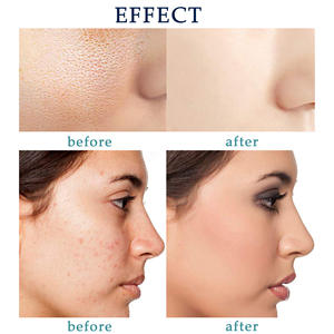 Etichetta privata sale del mar morto biologico cura della pelle naturale sapone di latte di capra fatto a mano personalizzato corpo sbiancante Savon Eclaircissan - Product Image 6