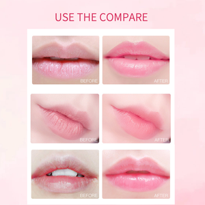 Mascarilla Labial Reparadora de Colágeno Hidrogel con Aloe Vera y Fresa, Personalizada al por Mayor, Reduce la Sequedad de Labios, Blanqueadora - Product Image 3