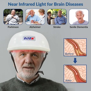 Casco de Fotobiomodulación con Luz Infrarroja Cercana (NIR) de 1070nm para <span class=keywords><strong>Migraña</strong></span>, Depresión, <span class=keywords><strong>Ansiedad</strong></span>, Accidente Cerebrovascular y Alzheimer - Product Image 3