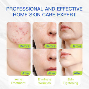 LED-Gesichts maschine Biomol Rot-und Infrarot lichttherapie Schmerz linderung gerät LED Medical Grade Rotlicht therapie Ganzkörper panel - Product Image 4