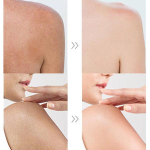 Crème <span class=keywords><strong>solaire</strong></span> <span class=keywords><strong>teintée</strong></span> SPF 60 pour le <span class=keywords><strong>visage</strong></span>, 50g, marque privée, crème <span class=keywords><strong>solaire</strong></span> coréenne pour peaux noires - Product Image 3