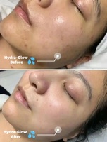 Sérum professionnel hydratant pour le visage à l'acide hyaluronique et PDRN, Ampoules de traitement Aqua Booster pour une peau éclatante, 10 flacons