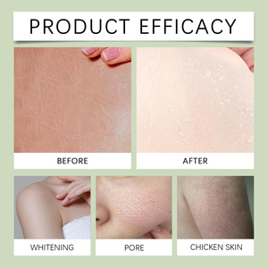 Savon OceAura en gros pour l'eczéma <span class=keywords><strong>et</strong></span> le psoriasis, nettoyant en profondeur, hydratant, soulageant la peau sèche, irritée <span class=keywords><strong>et</strong></span> squameuse, savon pour le visage <span class=keywords><strong>et</strong></span> le corps au <span class=keywords><strong>lait</strong></span> <span class=keywords><strong>de</strong></span> chèvre - Product Image 5