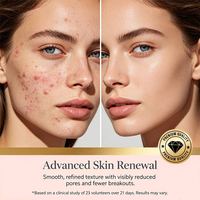 Crème Visage et Corps à l'Acide Salicylique OEM – Aide à Lisser et Adoucir la Texture de la Peau, Traitement Anti-Acné et Anti-Imperfections, Tonifiant et Éclaircissant les Pores