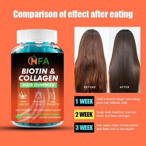 อาหารเสริมสารสกัดจากวิตามิน B6ออร์แกนิกที่กำหนดเองช่วยบำรุงสุขภาพเส้นผมให้ดูเปล่งปลั่งไบโอตินและคอลลาเจน - Product Image 6