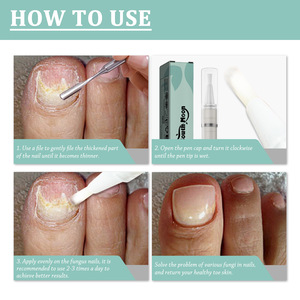 SOUTH MOON Stylo Sérum Réparateur Anti-Fongique Naturel à Base de Plantes pour les <span class=keywords><strong>Ongles</strong></span> - Product Image 3