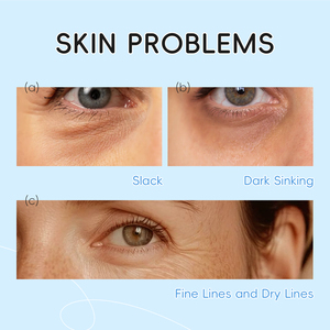 Sérum pour les yeux hydratant au lait LAIKOU avec triple applicateur à bille 15ml – Lisse les rides, atténue les cernes, crème anti-âge pour les yeux - Product Image 4