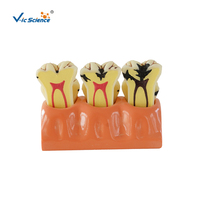 Modelo de Descomposición de Caries Dentales con Aumento 4X, Modelo Desmontable de la Estructura Interna del Diente Deciduado, CE/ISO/ROHS/CNAS