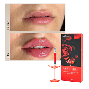 Remplisseur de lèvres rouge de haute qualité 1 ml, <span class=keywords><strong>acide</strong></span> <span class=keywords><strong>hyaluronique</strong></span> réticulé VB12, volumateur naturel pour l'<span class=keywords><strong>augmentation</strong></span> des lèvres - Product Image 1