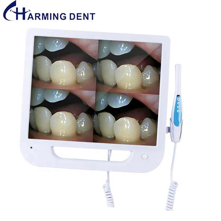 17 インチデジタルモニター付口腔内カメラ 17 インチデジタルモニター付口腔内カメラ