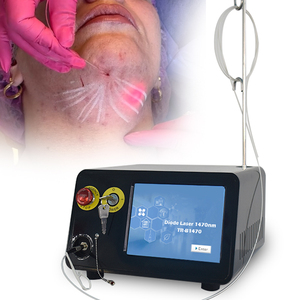 Dispositivo Endoláser Facial 1470nm para Lifting, Liposucción y Eliminación de Papada – Máquina de Lipólisis Láser 1470nm - Product Image 2