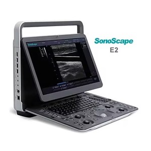 Sonoscape siêu âm e2v/E2/E11 E nối tiếp máy tính xách tay kỹ thuật số siêu âm DOPPLER Màu thú y chẩn đoán hệ thống siêu âm với 3 đầu dò - Product Image 1