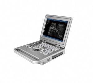 Beste kwaliteit zwart-wit draagbare echografiemachine, ultrasonische diagnostische systeem voor mensen, MSLPU11 apparatuur - Product Image 3