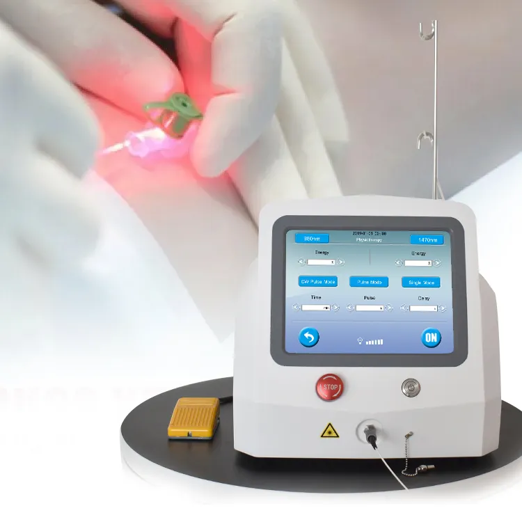 Laser Endovene, Perawatan Laser 1470 Vaskular dan Vena, Laser Terapi EVLT Endovena