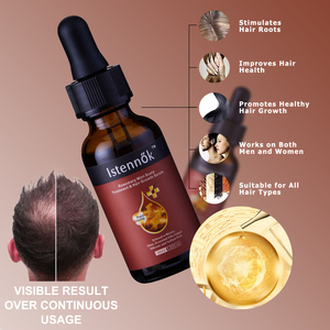 <span class=keywords><strong>Tonico</strong></span> <span class=keywords><strong>naturale</strong></span> per la crescita dei capelli per la cura del cuoio capelluto 30ml di estratti di erbe cinesi di alta qualità olio di cocco allo zenzero biologico di menta piperita - Product Image 5