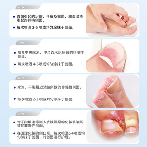 Pansement liquide médical OEM à base de plantes pour les plaies du pied, formule pour le soin des pieds, soulagement des rougeurs - Product Image 3