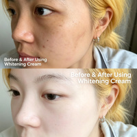 Crème éclaircissante au glutathion et aux perles avec acide kojique et vitamine C - Crème anti-âge pour le visage pour la réduction des taches brunes