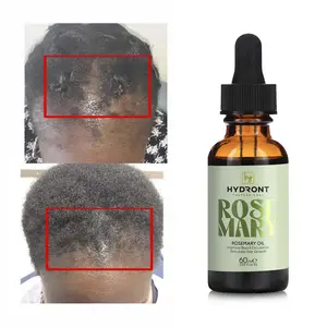Aceite de Romero natural para el crecimiento del cabello, aceite de suero para el crecimiento rápido del cabello salvaje para mujeres y hombres negros, aceite para el crecimiento del cabello de marca privada