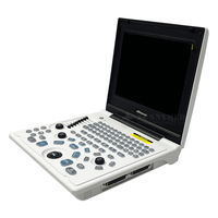 Échographe Numérique Portable SY-AX50-1 pour Ordinateur Portable, Échographie Cardiaque et Fonctionnelle en Noir et Blanc pour Usage Humain et Vétérinaire