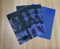 Film Cetak Gambar X-Ray Kompatibel Printer Inkjet, Bahan PET Tahan Air, Warna Biru Medis, Harga Grosir Pabrik, Laris Terjual