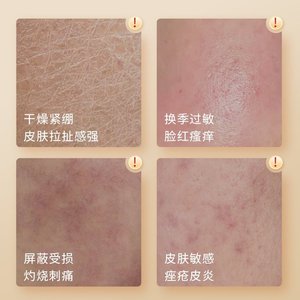 Spray Reparador de Colágeno de Grado Médico Haishi Hainuo para Acné, Dermatitis, Eccema, Sensibilidad, Picazón, Hidratante, Cuidado de la Piel - Product Image 1